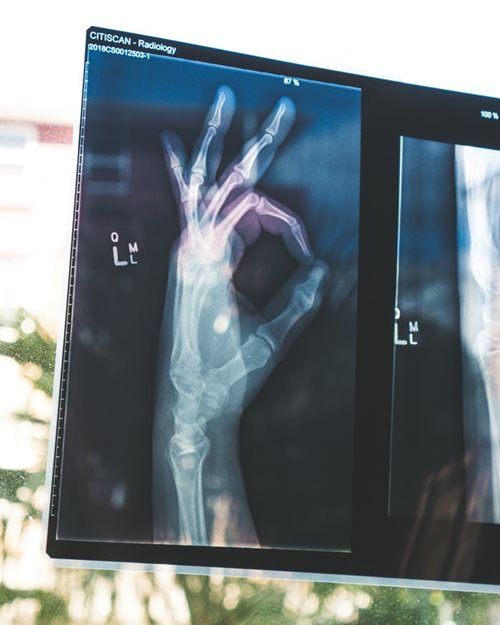 Radiografía de mano haciendo gesto de ok